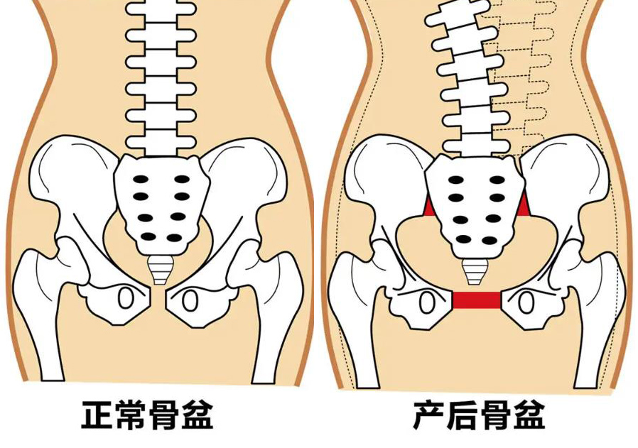 产后康复师